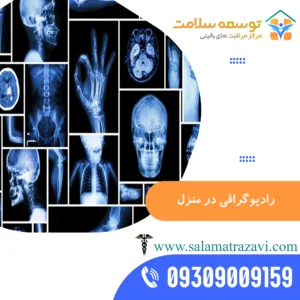 رادیولوژی در منزل مشهد