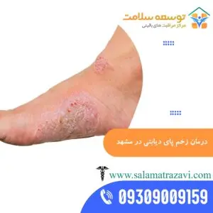 درمان زخم دیابتی در منزل مشهد